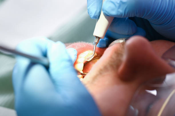 Best Emergency Tooth Extraction  in Joshua Tree, CA