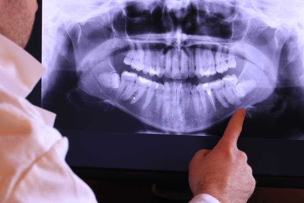 Best Broken Tooth Emergency  in Joshua Tree, CA